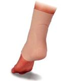 ACHILLES HEEL GEL SM/MED SLEEVE, EACH